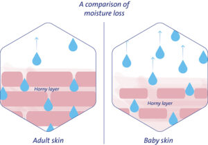 Comparison of moisture loss in adult and baby skin