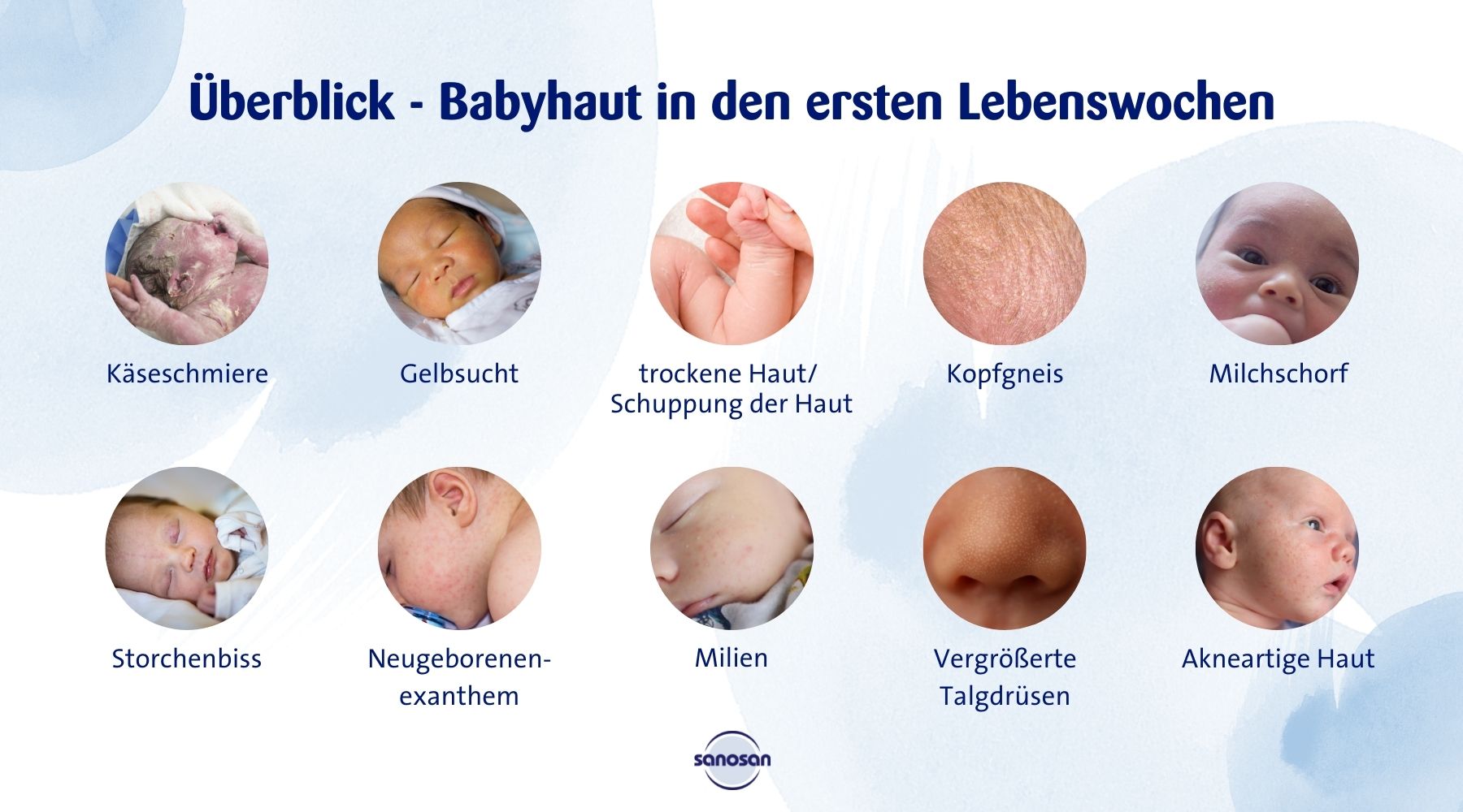 Überblick - Babyhaut in den ersten Lebenswochen Infografik
