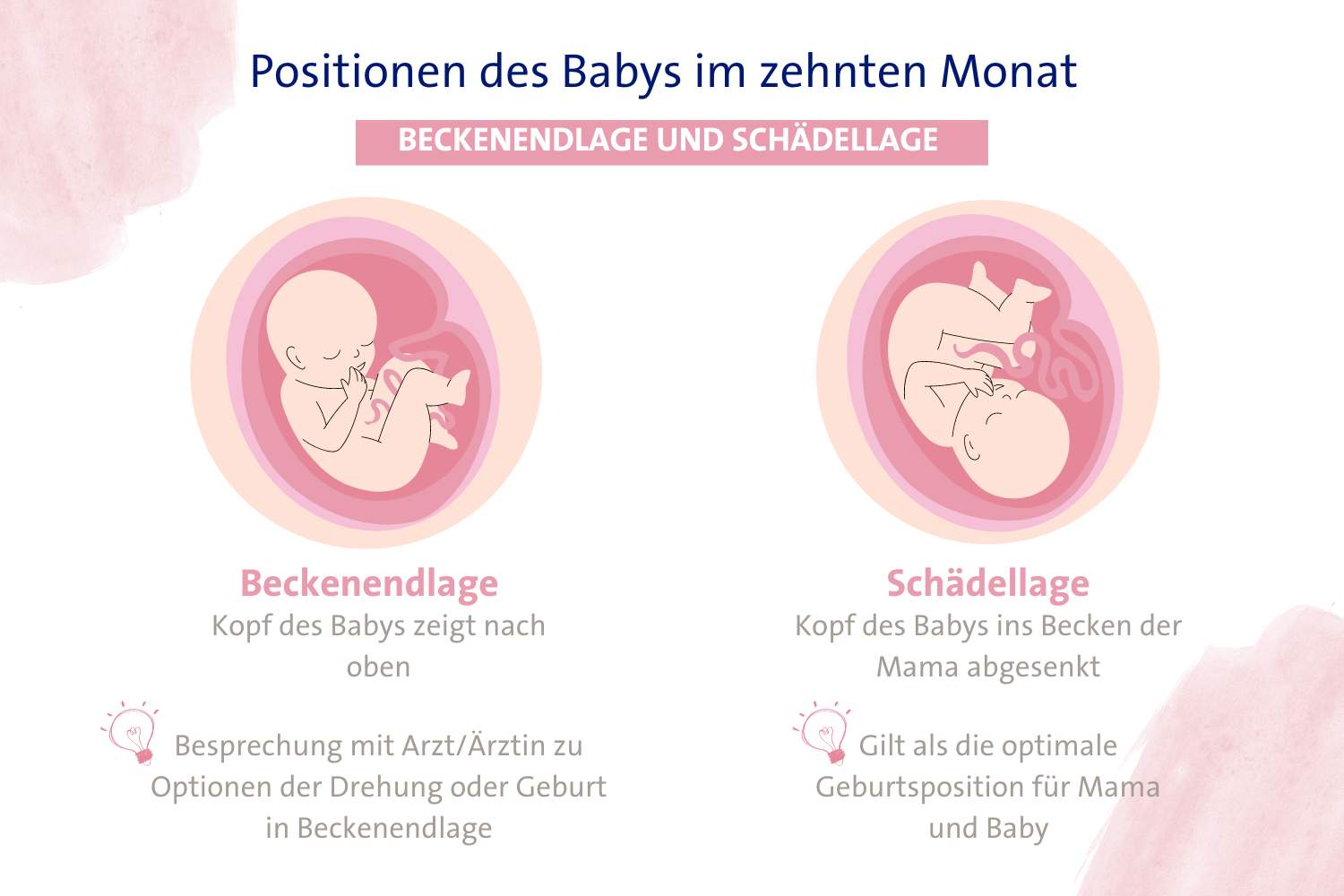 Infografik zu Beckenendlage und Schädellage als Geburtspositionen des Babys